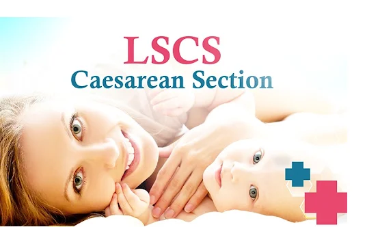 Cesarean Section