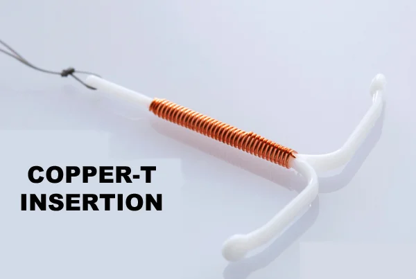 Copper-T Insertion