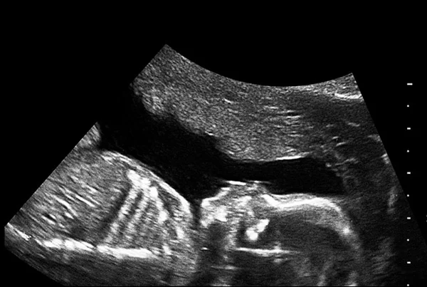 USG Scan Level 1, 2, 3