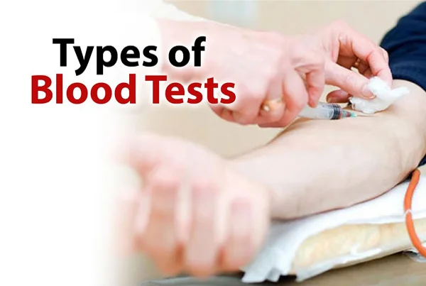 All Types of Blood Test